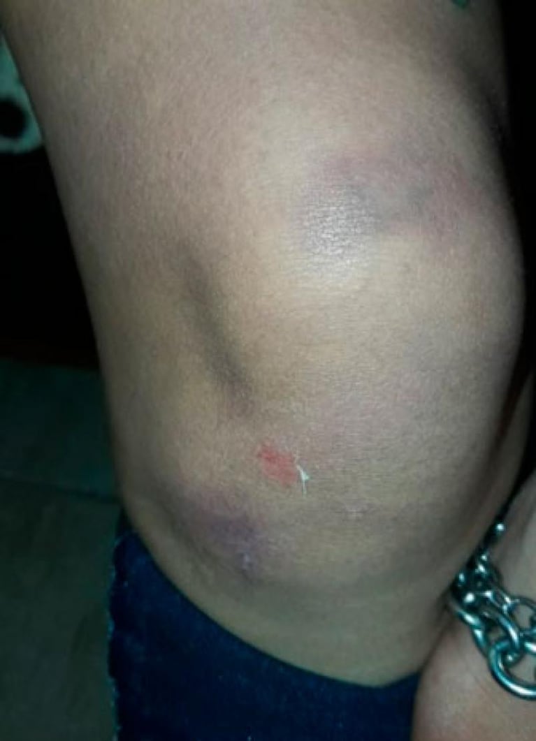 Villa María: una joven fue brutalmente golpeada por su expareja