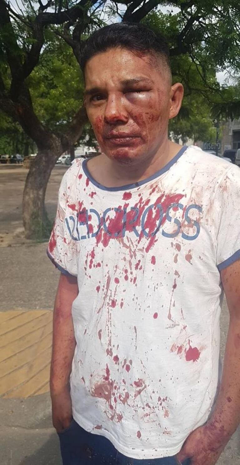 Violenta pelea a la salida de un boliche dejó dos heridos en Alta Córdoba