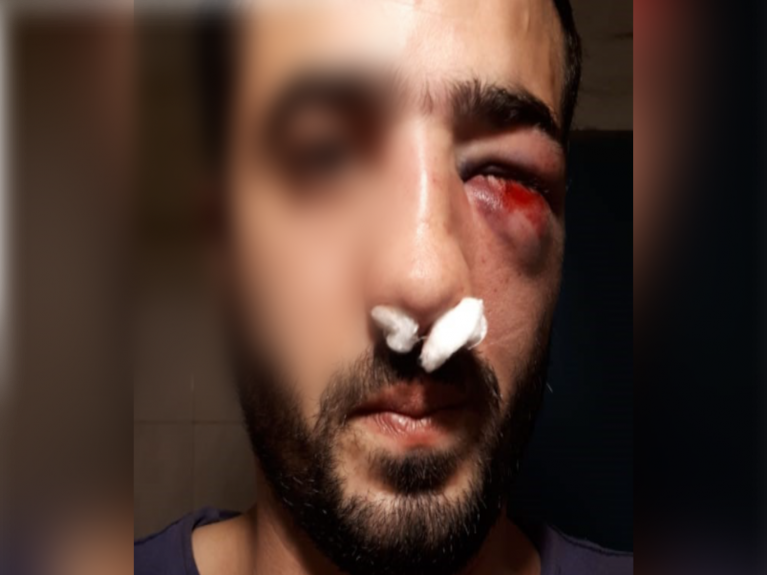 Violenta protesta del SUOEM: así agredieron al verdulero
