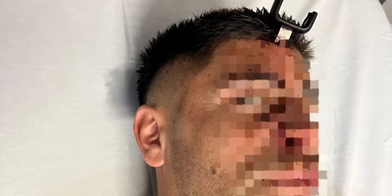 Violento ataque en un partido de futbol.