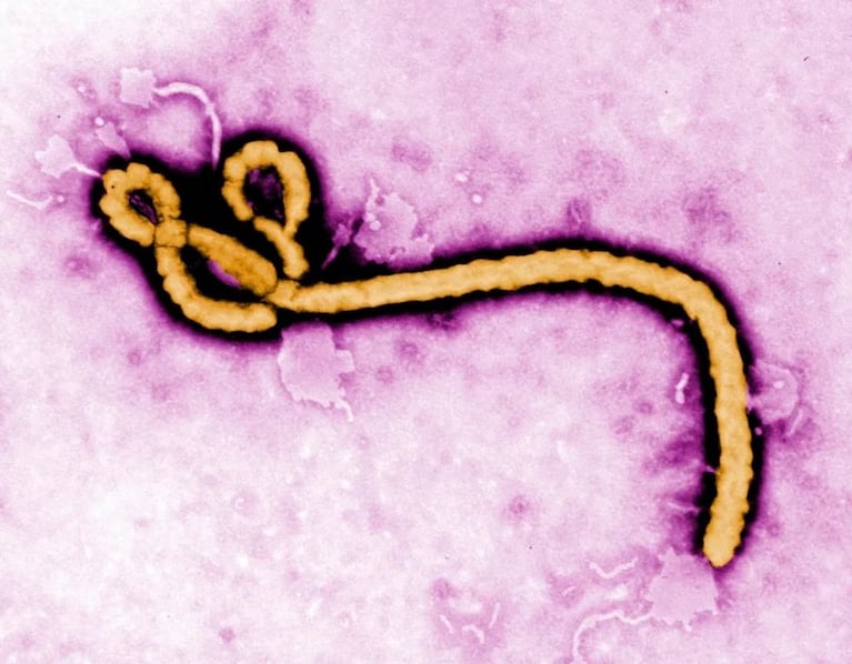 Virus del Ébola.