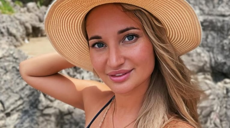 Yulia Burtseva falleció tras someterse a una cirugía estética en Moscú.